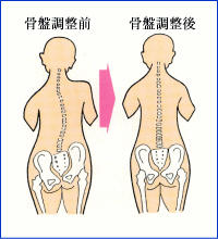 骨盤調整.gif